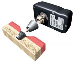 Bone Anchored Hearing Aids