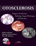 Otosclerosis book